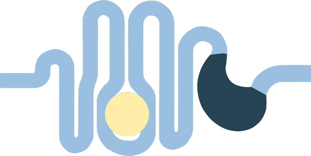 vereinfachte grafik eines magen darm komplexes mit einem störenden großen element im darm